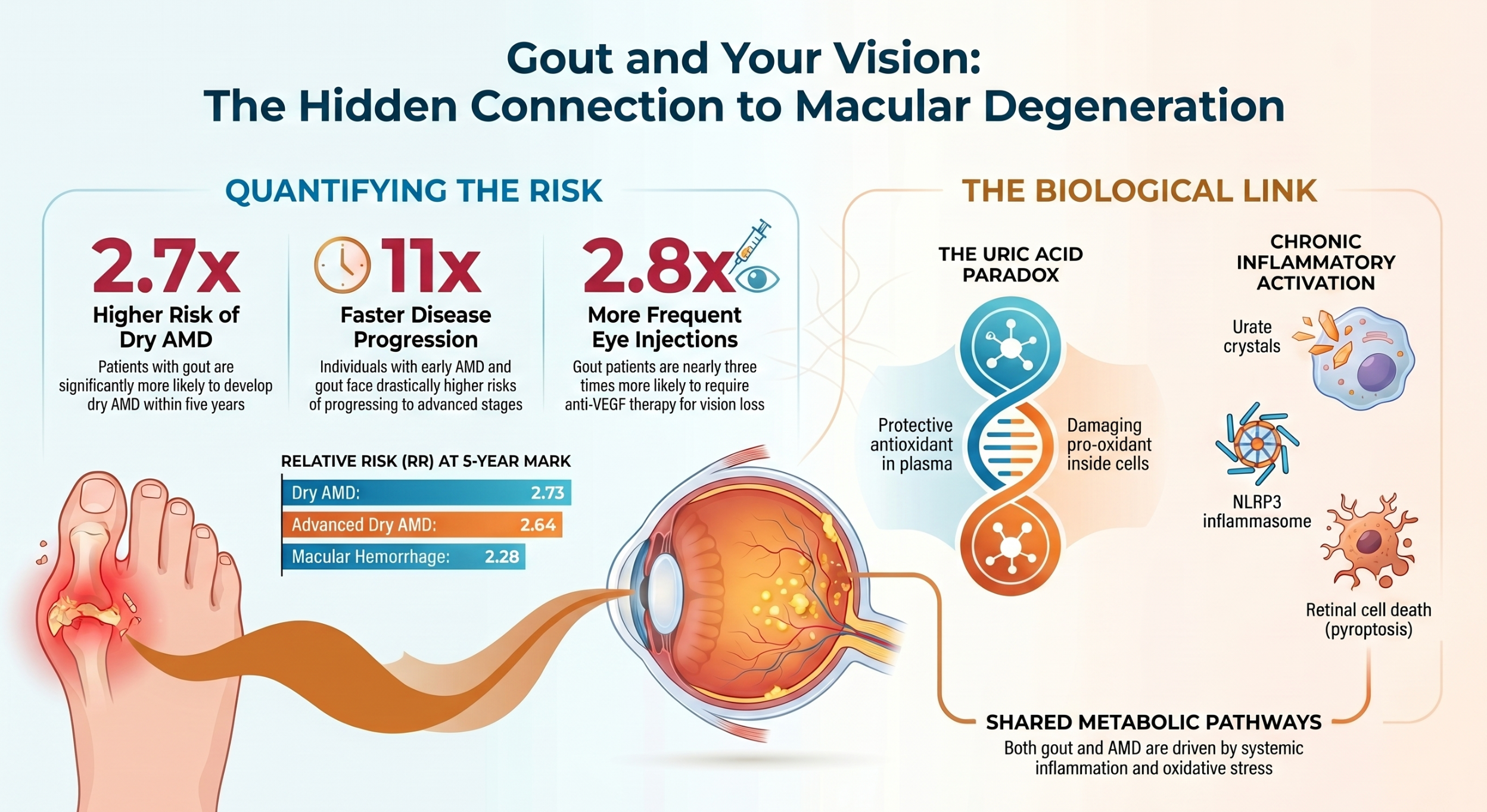 Could High Uric Acid Affect Your Eye Health?
